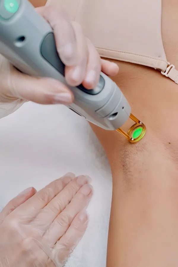 Hygienische Vorbereitung für Laser-Haarentfernung München - Saubere und sichere Behandlung