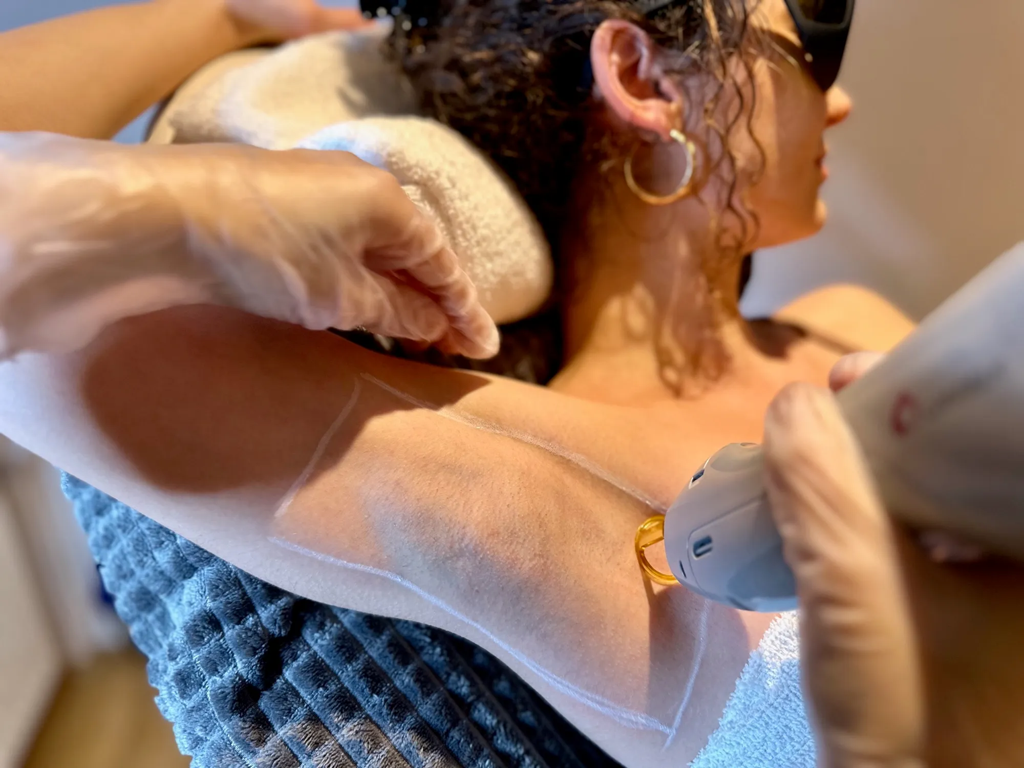 Professionelle Laser-Behandlung deine Ohren in München