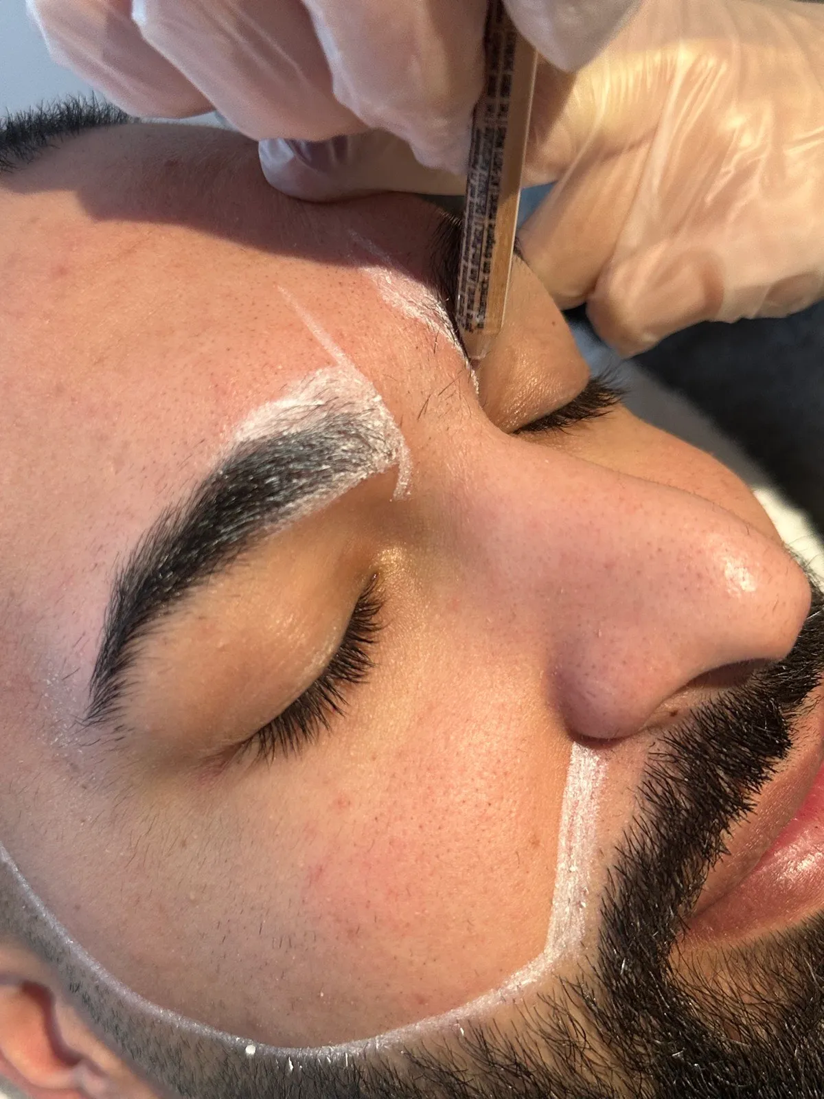 Professionelle Augenbrauen Laser-Haarentfernung Behandlung im HelloHairless Studio München